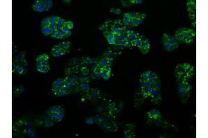 Image no. 3 for anti-Proteasome (Prosome, Macropain) 26S Subunit, ATPase, 3 (PSMC3) antibody (ABIN1501335) (PSMC3 antibody)