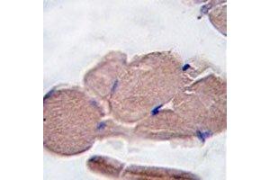 IHC analysis of FFPE human skeletal muscle tissue stained with Myostatin antibody (MSTN antibody  (AA 9-38))