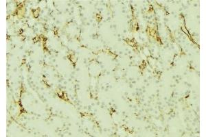 ABIN6277296 at 1/100 staining Mouse kidney tissue by IHC-P. (Dynamin 1-Like antibody  (C-Term))