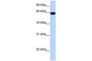 WB Suggested Anti-C16orf44 Antibody Titration:  0. (KLHL36 antibody  (Middle Region))