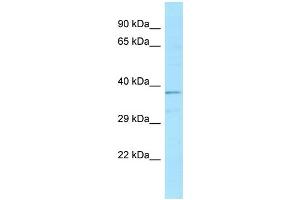 WB Suggested Anti-ATP6V0D1 Antibody Titration: 1.