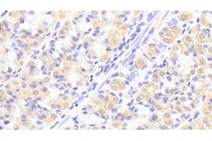 Detection of IL1RA in Human Stomach Tissue using Polyclonal Antibody to Interleukin 1 Receptor Antagonist (IL1RA) (IL1RN antibody  (AA 26-177))