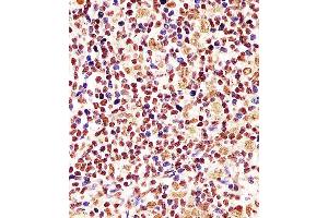 D staining Cyclin D1 in human tonsil tissue sections by Immunohistochemistry (IHC-P - paraformaldehyde-fixed, paraffin-embedded sections). (Cyclin D1 antibody  (AA 68-97))