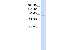 WB Suggested Anti-ADCY6 Antibody Titration:  0.