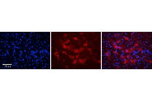 Rabbit Anti-DCAF11 Antibody      Formalin Fixed Paraffin Embedded Tissue: Human Adult Liver   Observed Staining: Cytoplasm in hepatocytes, strong signal, moderate tissue distribution  Primary Antibody Concentration: 1:100  Secondary Antibody: Donkey anti-Rabbit-Cy3  Secondary Antibody Concentration: 1:200  Magnification: 20X  Exposure Time: 0. (DCAF11 antibody  (N-Term))