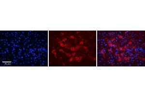 Rabbit Anti-DCAF11 Antibody      Formalin Fixed Paraffin Embedded Tissue: Human Adult Liver   Observed Staining: Cytoplasm in hepatocytes, strong signal, moderate tissue distribution  Primary Antibody Concentration: 1:100  Secondary Antibody: Donkey anti-Rabbit-Cy3  Secondary Antibody Concentration: 1:200  Magnification: 20X  Exposure Time: 0. (DCAF11 antibody  (N-Term))