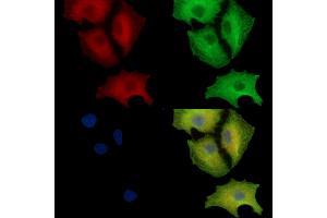 ABIN7097135 and ABIN7101203 staining  cells by IF/ICC. (CRELD2 antibody)
