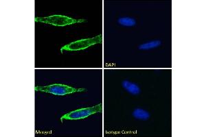 Immunofluorescence staining of fixed HeLa cells with anti-CD98 antibody CP1-5. (Recombinant SLC3A2 antibody)