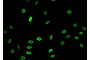 Immunofluorescent analysis of Hela cells treated with NaB using ABIN7139173 at dilution of 1:100 and Alexa Fluor 488-congugated AffiniPure Goat Anti-Rabbit IgG(H+L) (HIST1H3A antibody  (acLys23))