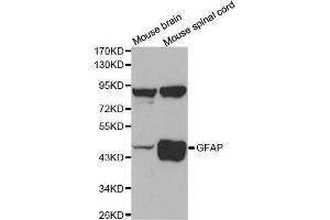 Western Blotting (WB) image for anti-Glial Fibrillary Acidic Protein (GFAP) (C-Term) antibody (ABIN3020751) (GFAP antibody  (C-Term))