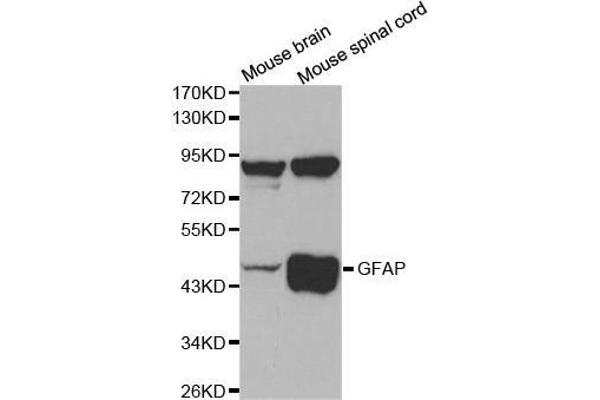 GFAP antibody  (C-Term)