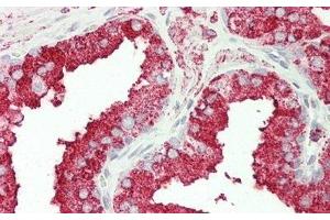 Detection of CPT1A in Human Prostate Tissue using Polyclonal Antibody to Carnitine Palmitoyltransferase 1A, Liver (CPT1A) (CPT1A antibody  (AA 191-353))