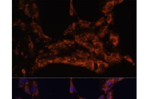 Immunofluorescence analysis of C6 cells using IL18 Polyclonal Antibody at dilution of 1:100. (IL-18 antibody)