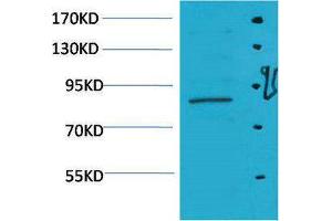Western Blotting (WB) image for anti-Signal Transducer and Activator of Transcription 5A (STAT5A) antibody (ABIN3181586) (STAT5A antibody)