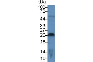 Detection of FGF13 in Rat Cerebrum lysate using Monoclonal Antibody to Fibroblast Growth Factor 13 (FGF13) (FGF13 antibody  (AA 108-227))