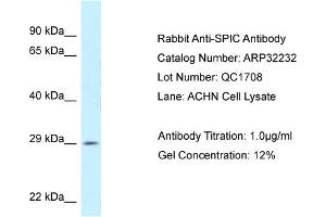 WB Suggested Anti-SPIC Antibody   Titration: 1. (SPIC antibody  (C-Term))