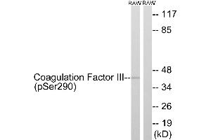 Immunohistochemistry analysis of paraffin-embedded human brain tissue using Coagulation Factor III (Phospho-Ser290) antibody.