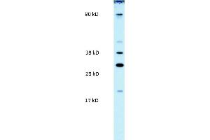 WB Suggested Anti-PAntibody Titration:  0. (PARP11 antibody  (N-Term))