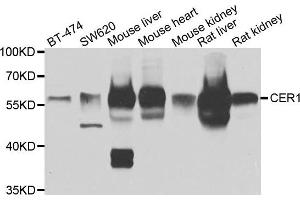 Western blot analysis of extracts of various cell lines, using CER1 antibody. (CER1 antibody)