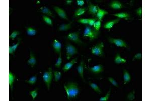 Immunofluorescence staining of U251 cells with ABIN7152751 at 1:200, counter-stained with DAPI. (Fibrillin 1 antibody  (AA 783-850))