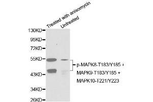 Western blot analysis of extracts from C6 cells untreated or treated with anisomycin using Phospho-MAPK8-T183/Y185 + MAPK9-T183/Y185 + MAPK10-T221/Y223 Antibody (ABIN2987800). (MAPK8/9/10 antibody  (pThr183, pThr221, pTyr185))