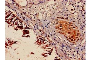 Immunohistochemistry of paraffin-embedded human lung tissue using ABIN7160596 at dilution of 1:100 (Myosin 9 antibody  (AA 2-241))