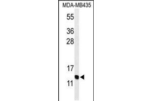 Western blot analysis of GNRH2 Antibody in MDA-MB435 cell line lysates (35ug/lane) (GnRH2 antibody  (AA 26-53))