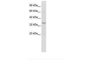 Image no. 1 for anti-Potassium Voltage-Gated Channel, Shaker-Related Subfamily, beta Member 2 (KCNAB2) (AA 240-289) antibody (ABIN202321) (KCNAB2 antibody  (AA 240-289))