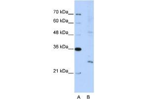 WB Suggested Anti-EXOSC4 Antibody Titration:  5. (EXOSC4 antibody  (N-Term))