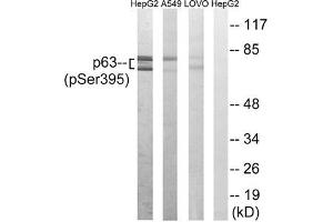 Western blot analysis of extracts from HepG2 cells, A549 cells and LOVO cells all treated with nocodazole (1 μg/mL, 18hours), using p63 (Phospho-Ser395) antibody. (p63 antibody  (pSer395))