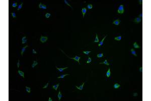 Immunofluorescence staining of SH-SY5Y cells with ABIN7168758-IF at 1:100, counter-stained with DAPI. (SEZ6 antibody  (AA 20-267))