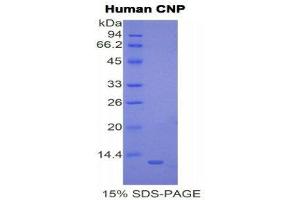 SDS-PAGE (SDS) image for Natriuretic Peptide Type C (NPPC) (AA 33-125) protein (His tag) (ABIN2120685)