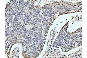 IHC analysis of MOV10 using anti-MOV10 antibody (ABIN7600236). (MOV10 antibody  (AA 167-772))