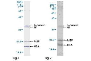 Kinase Activity Assay (KAA) image for Mitogen-Activated Protein Kinase Kinase Kinase 7 (MAP3K7) (AA 1-579) protein (GST tag) (ABIN1310225) (MAP3K7 Protein (AA 1-579) (GST tag))