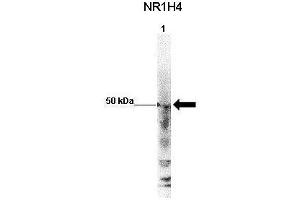 Western Blotting (WB) image for anti-Nuclear Receptor Subfamily 1, Group H, Member 4 (NR1H4) (Middle Region) antibody (ABIN2778066)