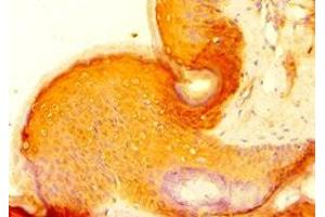 Immunohistochemistry of paraffin-embedded human skin tissue using ABIN7154835 at dilution of 1:100 (C14orf94 antibody  (AA 1-363))