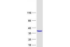 Western Blotting (WB) image for Tumor Protein P53 Inducible Protein 3 (TP53I3) (Transcript Variant 2) protein (Myc-DYKDDDDK Tag) (ABIN2734084)
