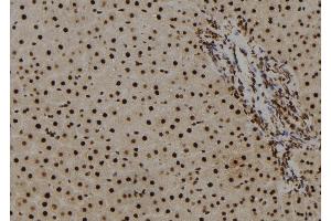 ABIN6278580 at 1/100 staining Rat liver tissue by IHC-P. (HIST1H2BH antibody  (N-Term))