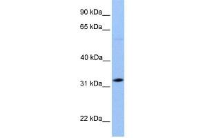 WB Suggested Anti-DNALI1 Antibody Titration: 0. (DNALI1 antibody  (C-Term))