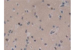 Immunohistochemistry (IHC) image for anti-Insulin-Like Growth Factor Binding Protein 1 (IGFBPI) (AA 36-235) antibody (ABIN7442780)