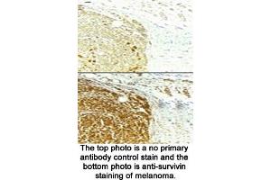 Image no. 2 for anti-Baculoviral IAP Repeat-Containing 5 (BIRC5) (full length) antibody (ABIN363387) (Survivin antibody  (full length))