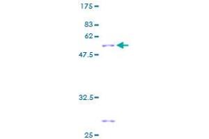 GSTK1 Protein (AA 1-226) (GST tag)