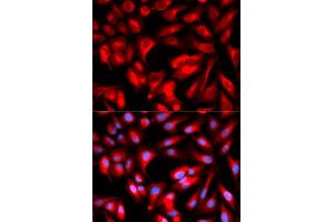 Immunofluorescence analysis of U2OS cells using CD168/RHAMM antibody (ABIN6131278, ABIN6141879, ABIN6141880 and ABIN6216074). (HMMR antibody  (AA 1-300))