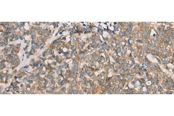 ATXN7 antibody