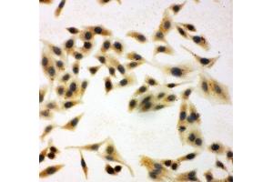 Immunocytochemistry (ICC) image for anti-Neuregulin 1 (NRG1) (C-Term) antibody (ABIN3031973)