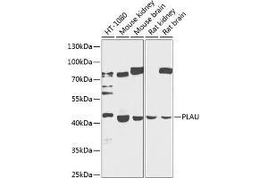 Western blot analysis of extracts of various cell lines, using PLAU antibody (ABIN3023141, ABIN3023142, ABIN3023143 and ABIN6219409) at 1:1000 dilution. (PLAU antibody  (AA 20-180))