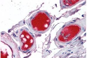 Small intestine, vessels: Formalin-Fixed, Paraffin-Embedded (FFPE) (Coagulation Factor X antibody)