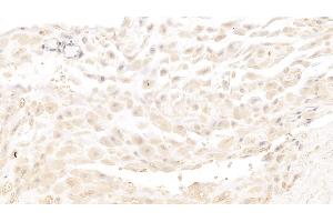 Detection of MBP in Human Placenta Tissue using Monoclonal Antibody to Major Basic Protein (MBP) (Major Basic Protein antibody  (AA 105-222))