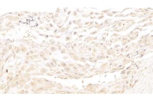 Detection of MBP in Human Placenta Tissue using Monoclonal Antibody to Major Basic Protein (MBP)