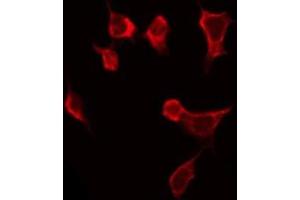 ABIN6268924 staining HeLa by IF/ICC. (TNFSF13 antibody  (Internal Region))